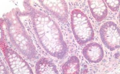 Immunohistochemistry-Paraffin: Claudin-3 Antibody [NBP3-14294] - Human Colon: Formalin-Fixed, Paraffin-Embedded (FFPE)